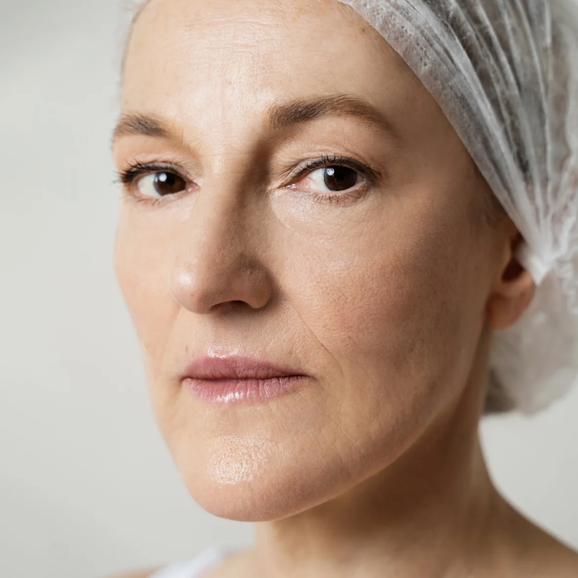 Before Face lift procedure at drbeauty