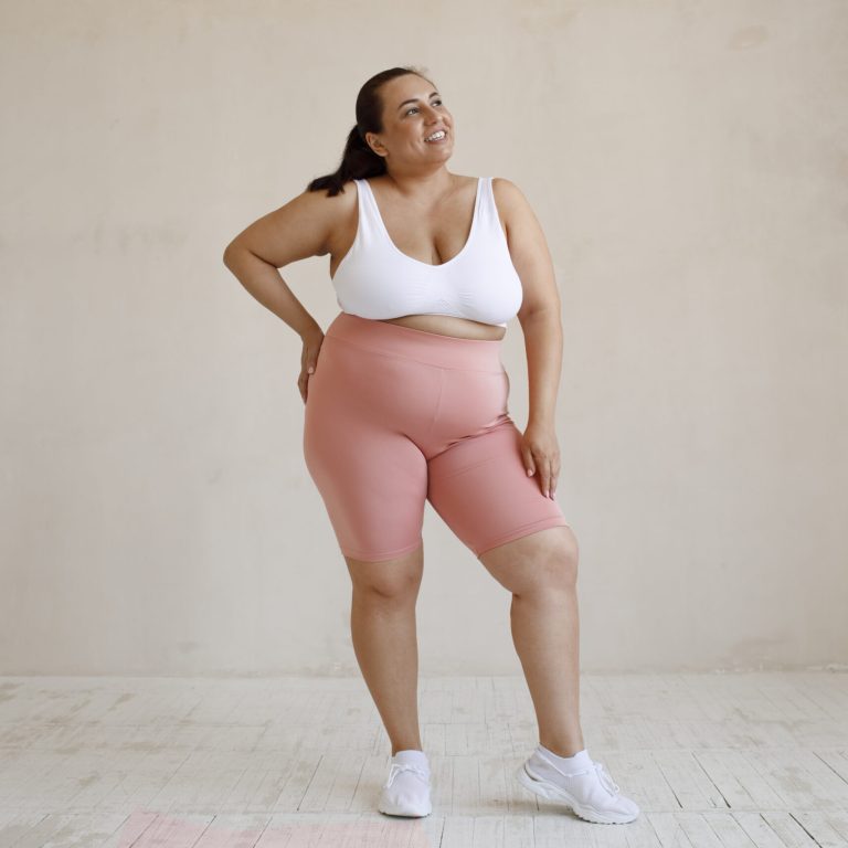 a woman patient in the photo before gastric bypass surgery