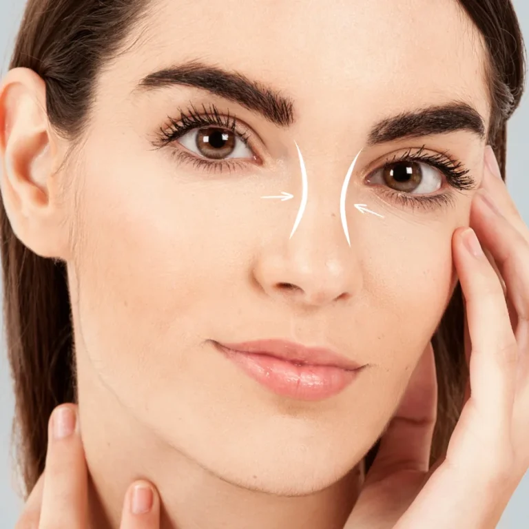 Rhinoplasty surgery nose job figure women in the photo