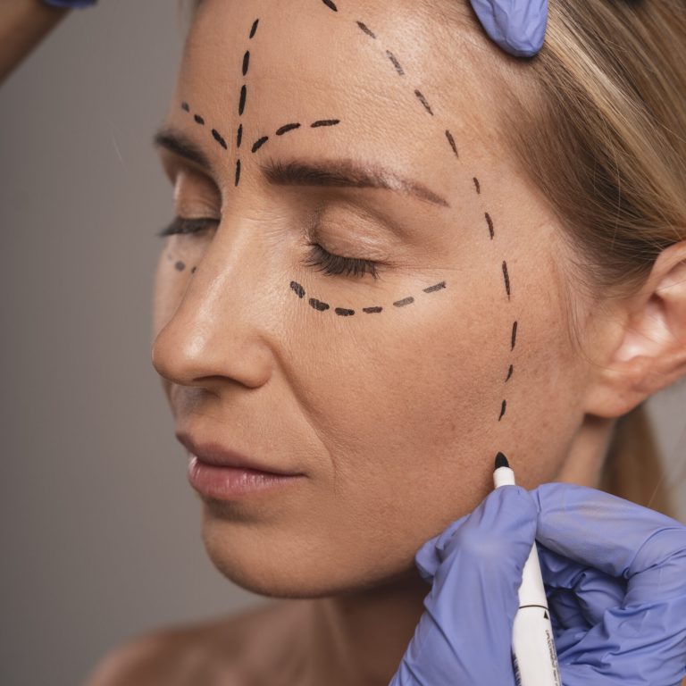 Doctor preparing patient for eyelid surgery